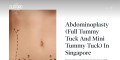 Singapore Tummy Tuck Surgery