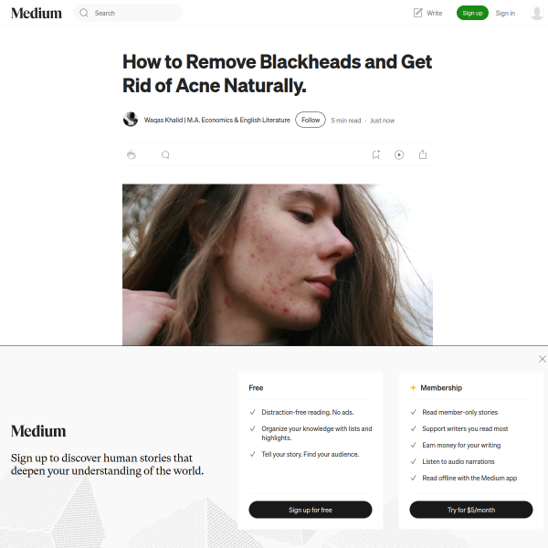 How to Remove Blackheads and Get Rid of Acne Naturally.