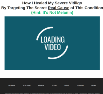 Vitiligo Miracle (tm) - Nothing Compares To This Crushing Vsl!                 