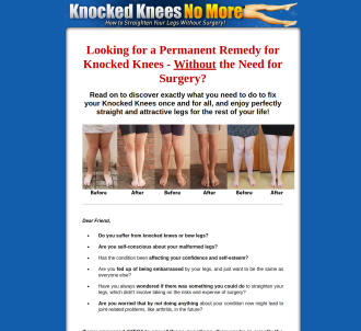 Knocked Knees No More - Hot For Year 2020!                                     