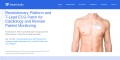 SmartCardia AI-Powered Remote Cardiac Monitoring Solutions