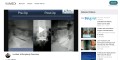 2011 Lumbar Arthroplasty Overview VuMedi