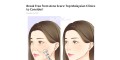 Three You'll Want To Get Rid Of Acne - Natural Uncomplicated Ways To Address Acne