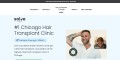 Hair Transplant Chicago