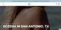 Eczema in San Antonio, TX