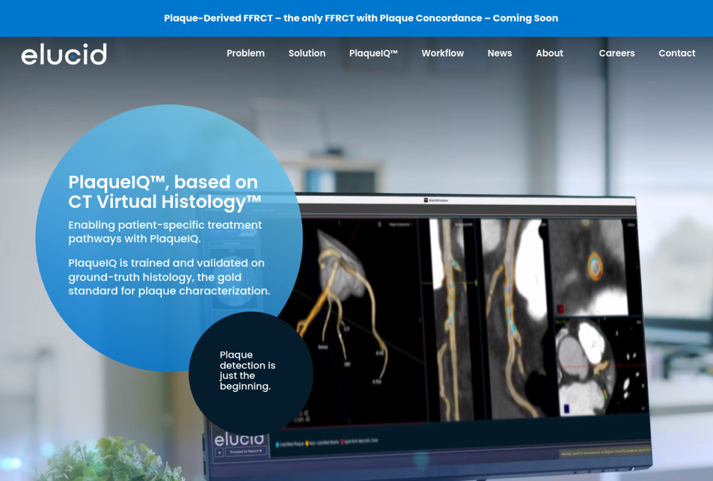 Screenshot of the official Elucid PlaqueIQ product page