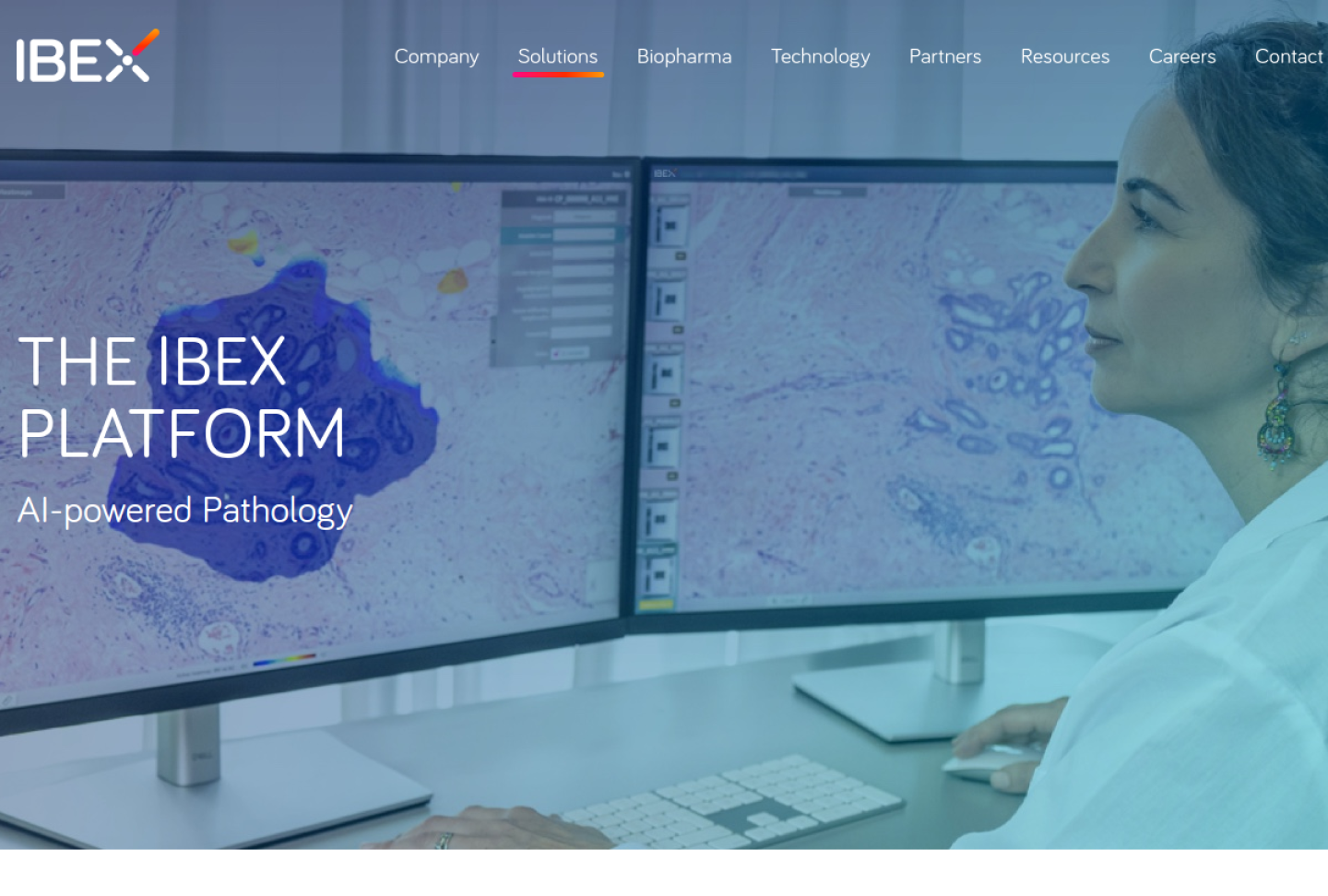 Screenshot of the official Ibex Medical Analytics product page