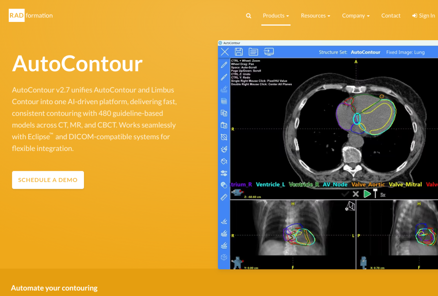 Screenshot of the official Radformation AutoContour product page