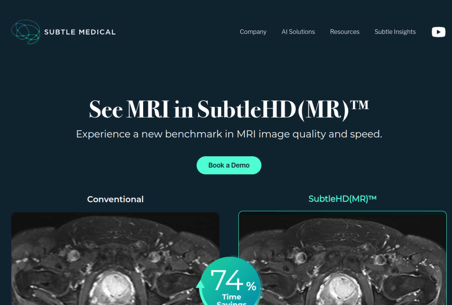 Screenshot of the official Subtle Medical product page