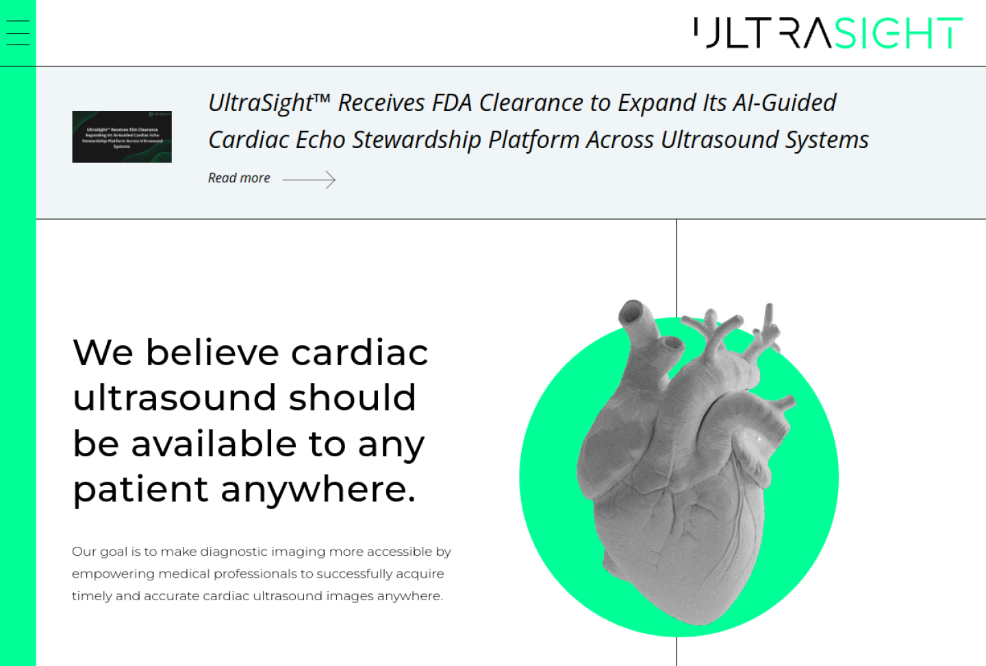 Screenshot of the official UltraSight Guidance product page