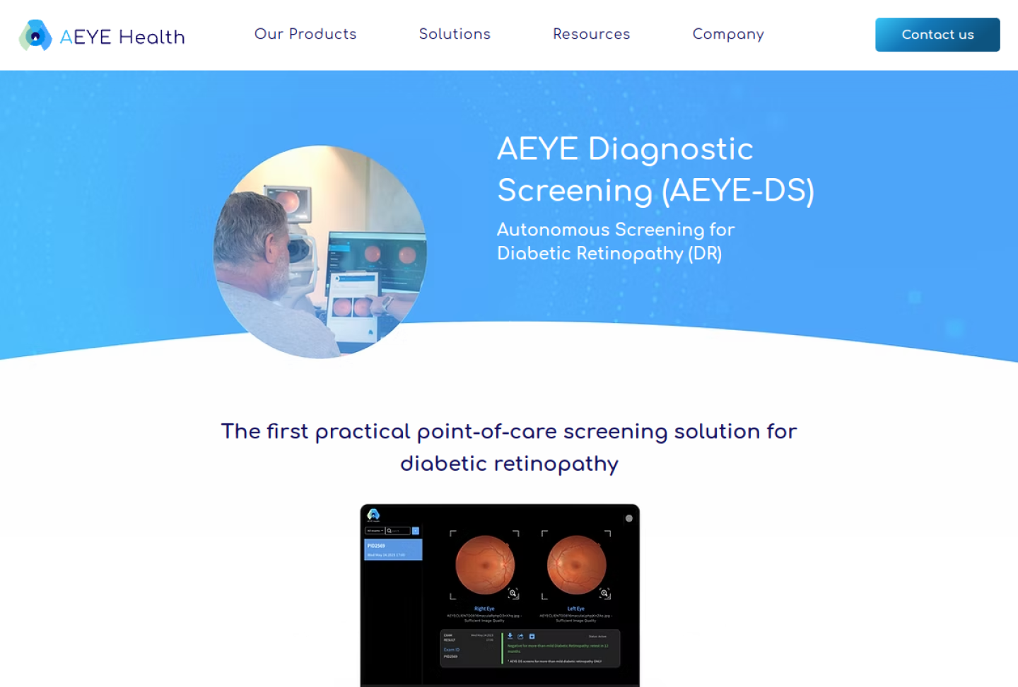 Screenshot of the official AEYE-DS product page