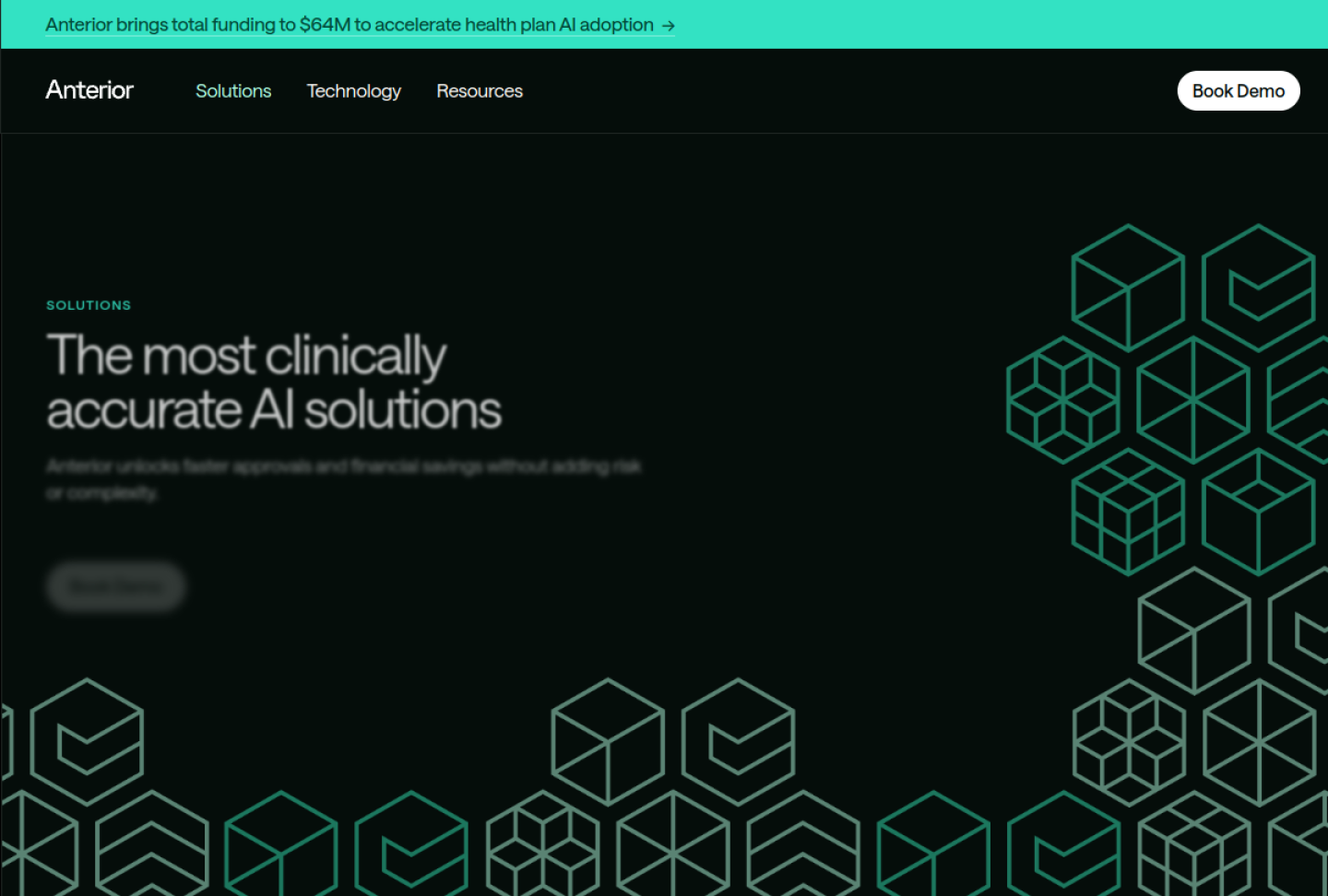 Screenshot of the official Anterior product page
