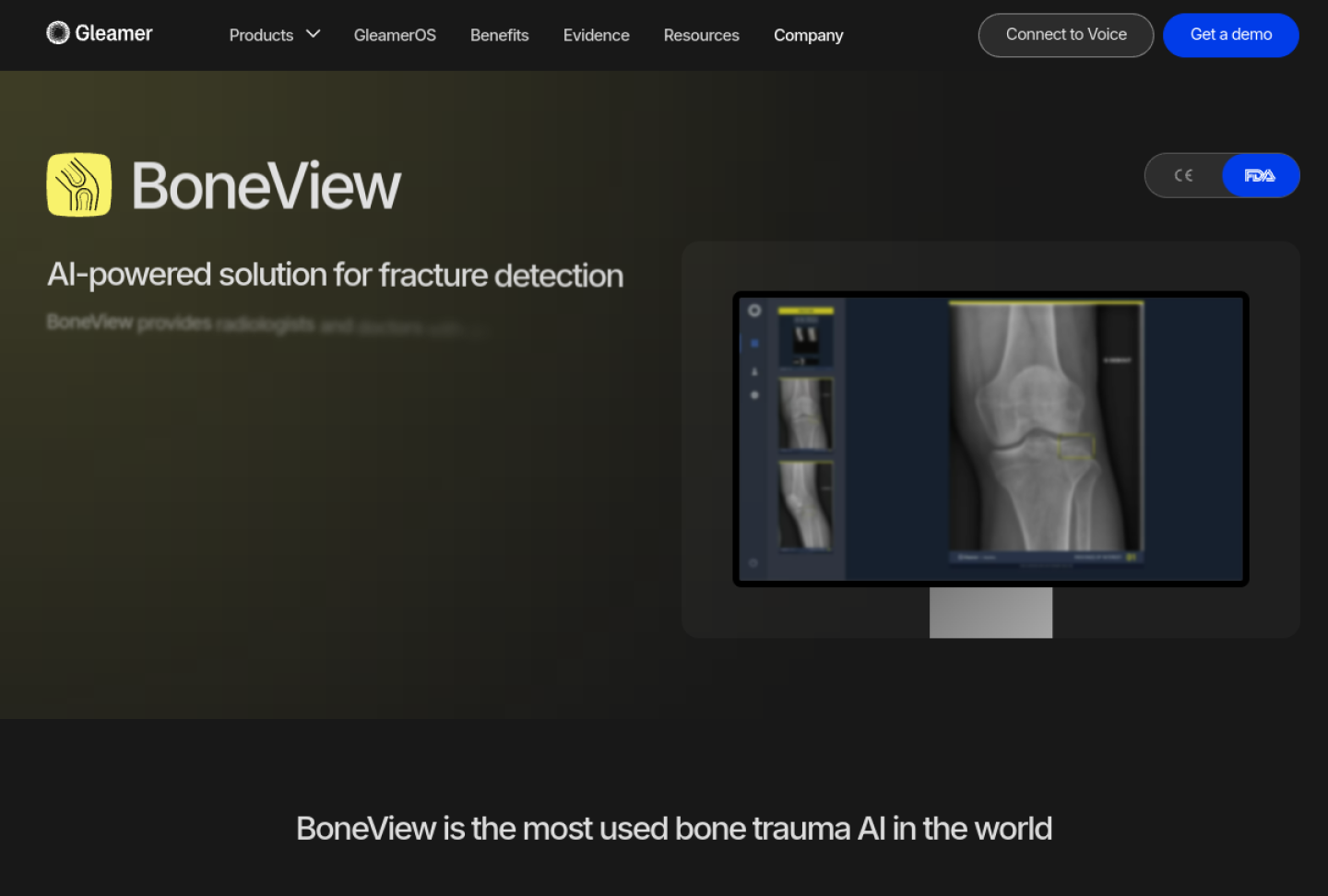 Screenshot of the official Gleamer BoneView product page