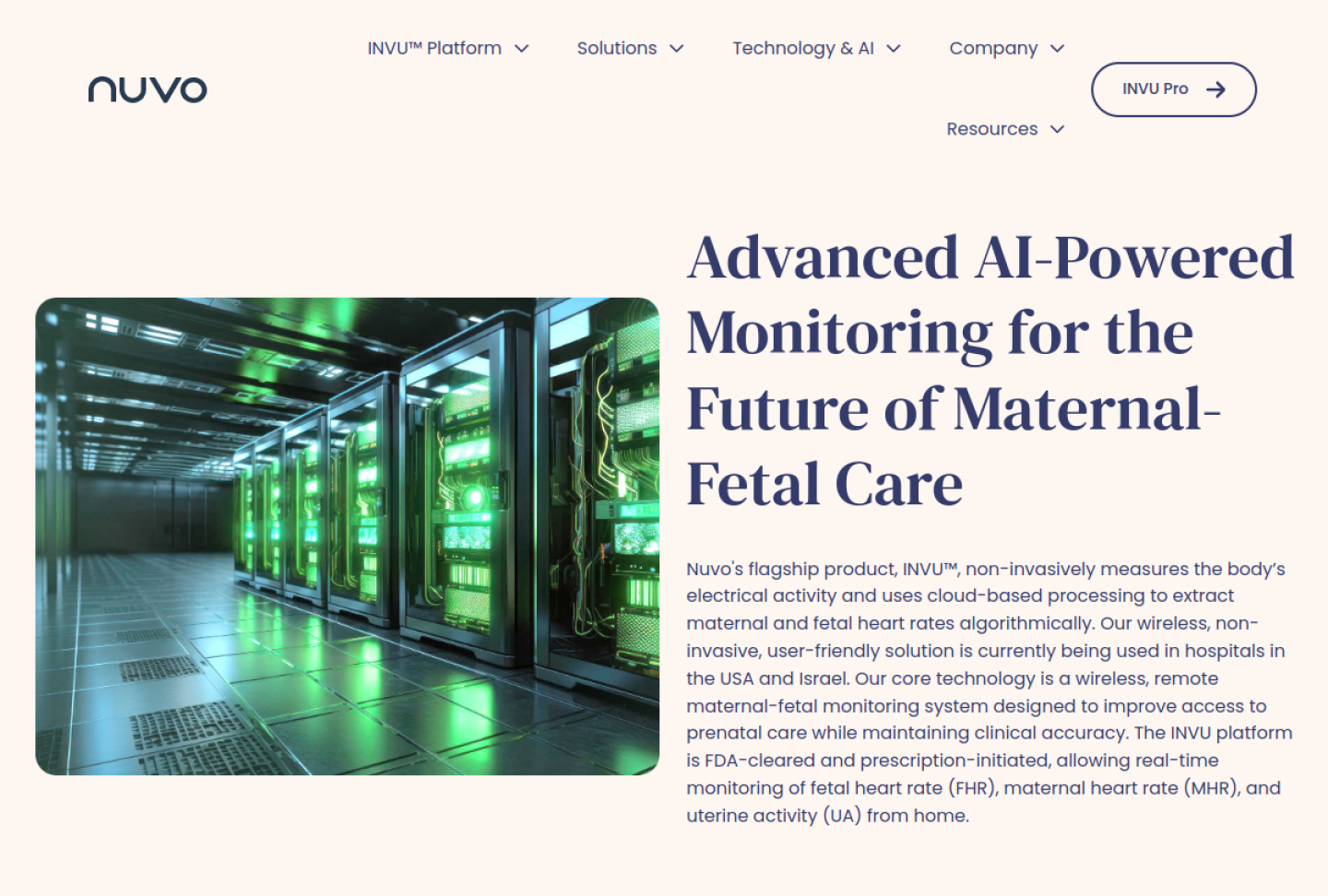 Screenshot of the official Nuvo INVU product page