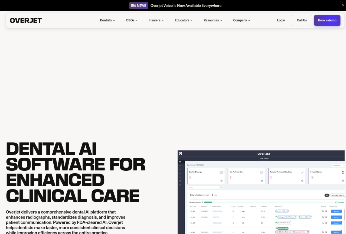 Screenshot of the official Overjet product page