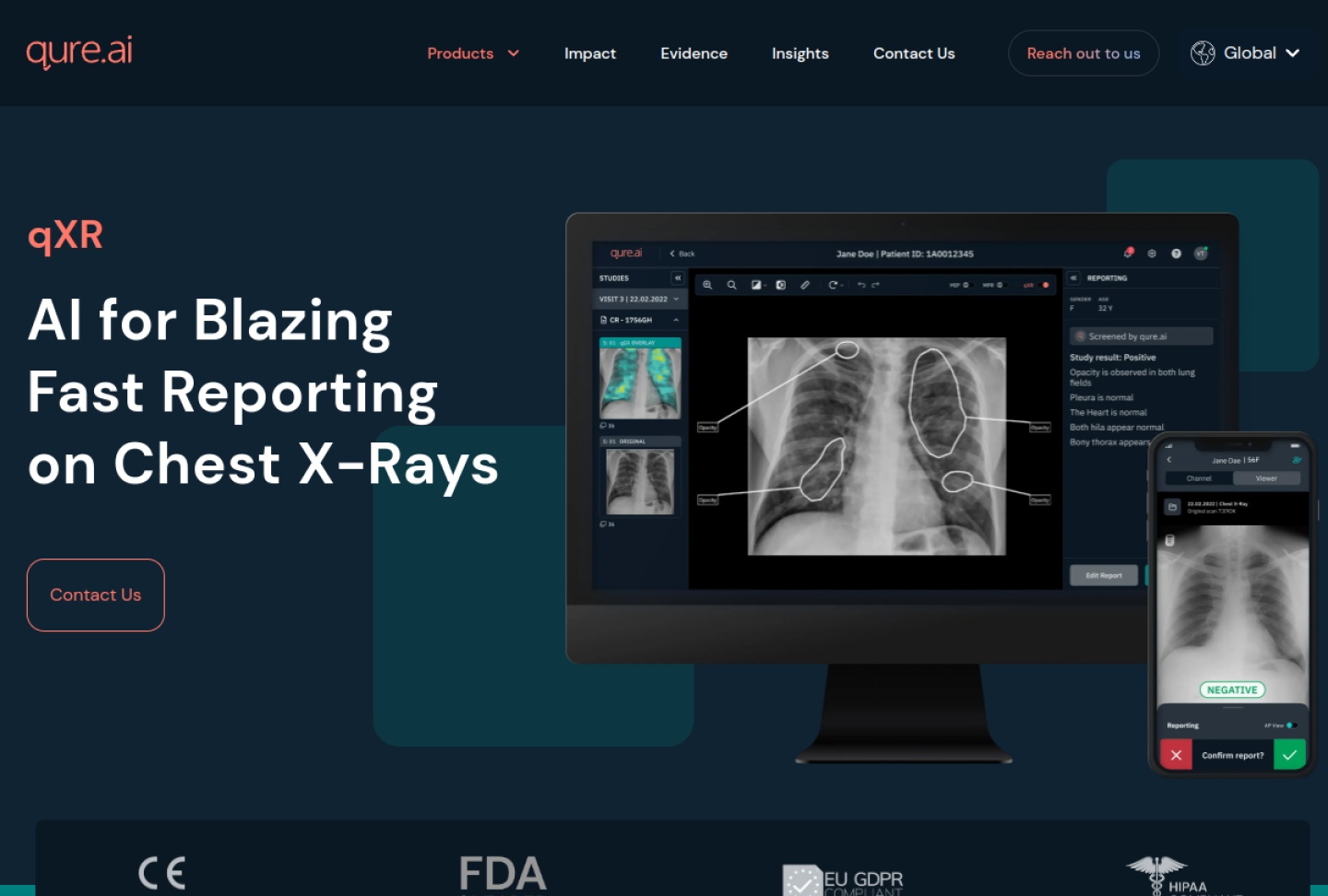 Screenshot of the official Qure.ai qXR product page