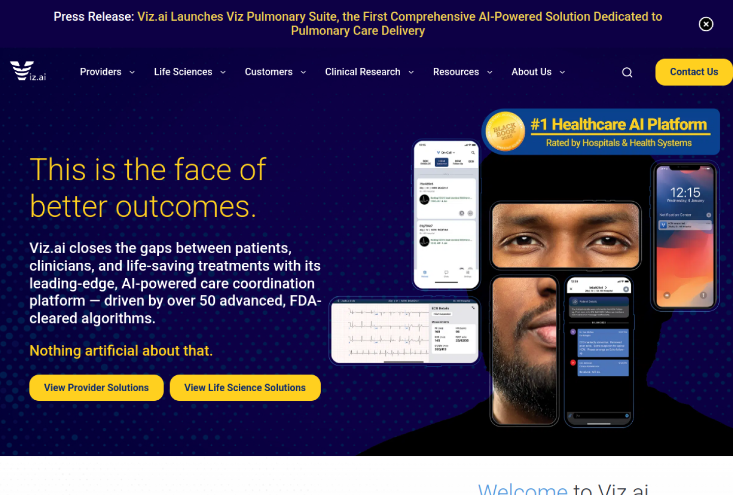 Screenshot of the official Viz.ai product page