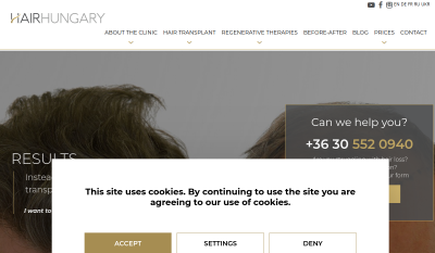 HairHungary - Hajbeültetés, Hajátültetés