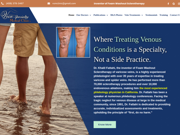 Varicose Veins Treatment Offering Minimally Invasive Solutions in San Jose
