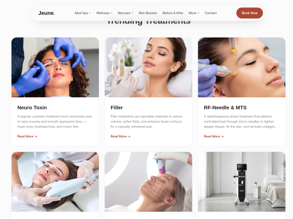 Botox Whittier CA