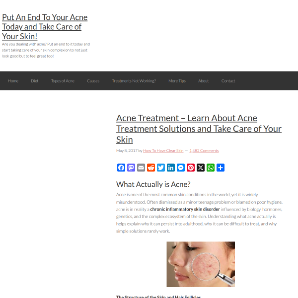acne101.info