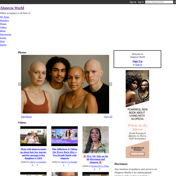alopeciaworld.com