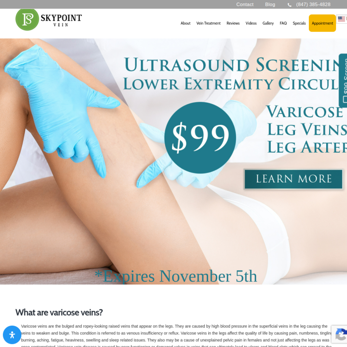 Skypoint Vein Center