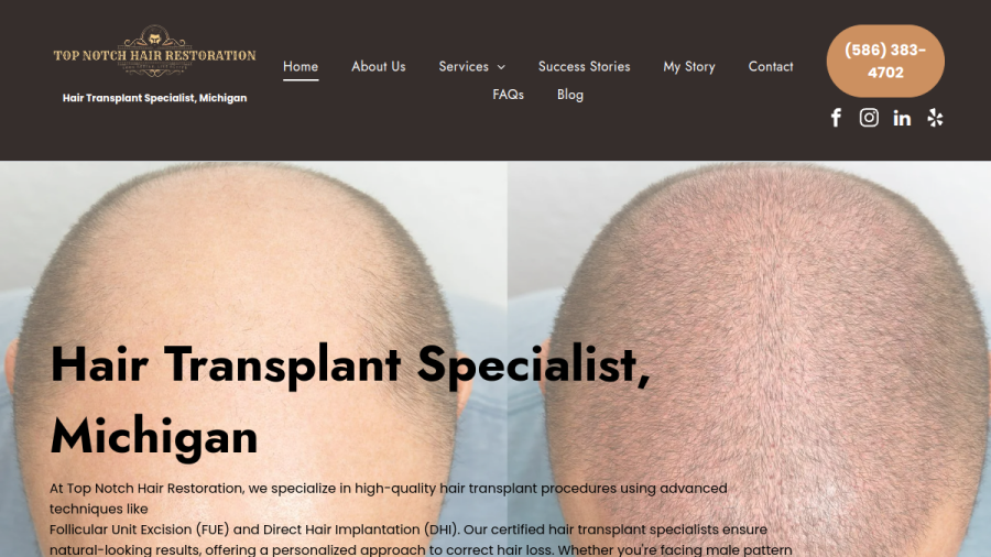 Screenshot of the Top Notch Hair Restoration website